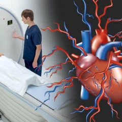 Sanal Koroner Anjiyografi